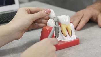 How Dental Implants Improve Oral Health